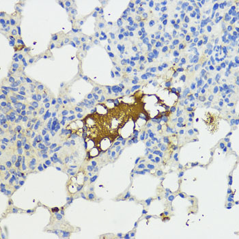 Complement factor B (CFB) Rabbit Polyclonal Antibody - Image 4