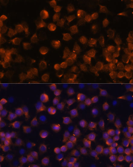 Complement factor B (CFB) Rabbit Polyclonal Antibody - Image 5