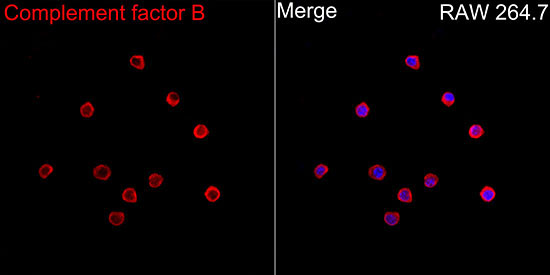 Complement factor B Rabbit Polyclonal Antibody - Image 3