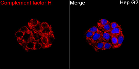 Complement factor H Rabbit Polyclonal Antibody - Image 2