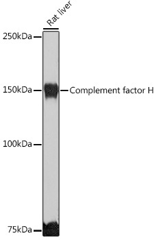 Complement factor H Rabbit Polyclonal Antibody - Image 2