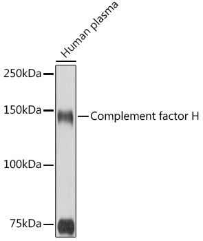 Complement factor H Rabbit Polyclonal Antibody - Image 3