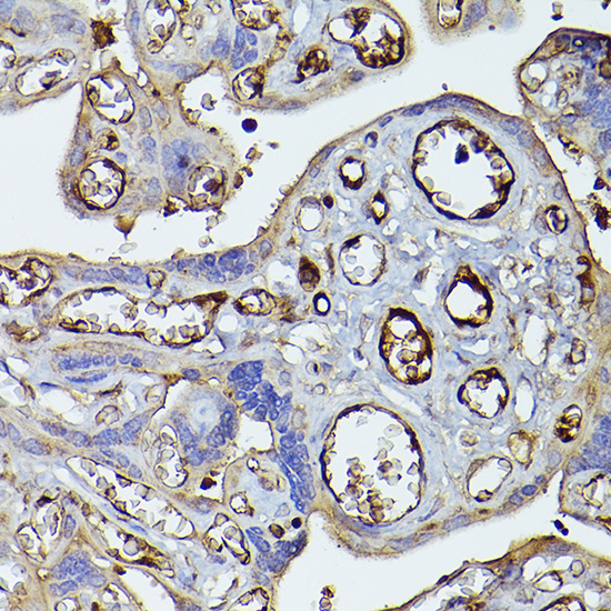 Complement factor H Rabbit Polyclonal Antibody - Image 4