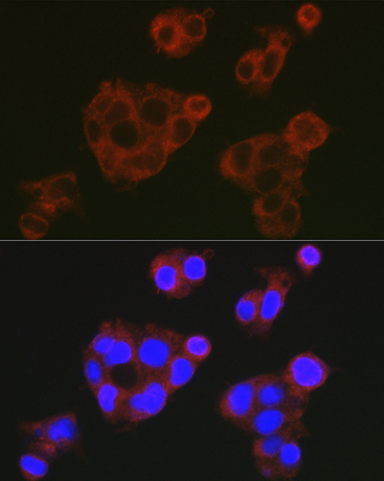 Complement factor H Rabbit Polyclonal Antibody - Image 5