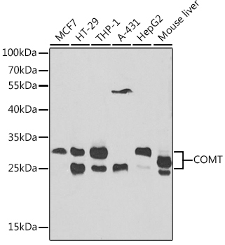 COMT Rabbit Polyclonal Antibody
