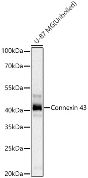 Connexin 43 Rabbit Monoclonal Antibody