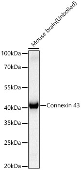 Connexin 43 Rabbit Monoclonal Antibody - Image 2