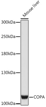 COPA Rabbit Polyclonal Antibody