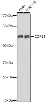 COPB1 Rabbit Polyclonal Antibody