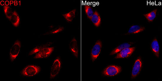 COPB1 Rabbit Polyclonal Antibody - Image 2