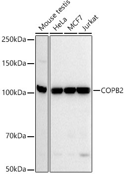 COPB2 Rabbit Monoclonal Antibody