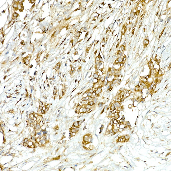 COPB2 Rabbit Polyclonal Antibody - Image 2