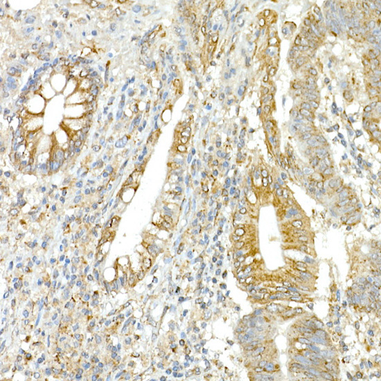 COPB2 Rabbit Polyclonal Antibody - Image 3