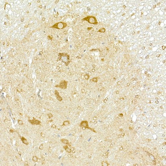 COPB2 Rabbit Polyclonal Antibody - Image 4