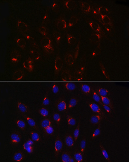 COPB2 Rabbit Polyclonal Antibody - Image 5