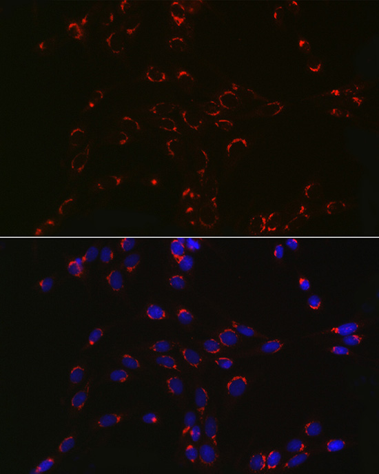 COPB2 Rabbit Polyclonal Antibody - Image 6