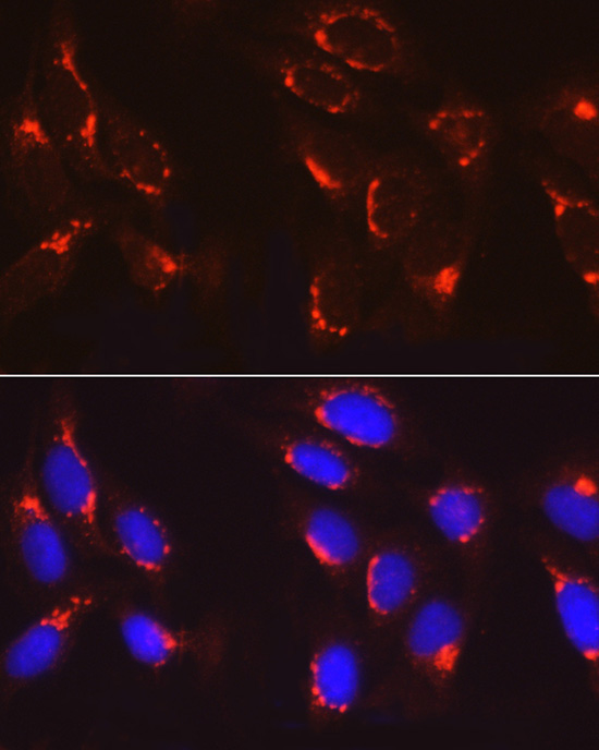 COPB2 Rabbit Polyclonal Antibody - Image 7