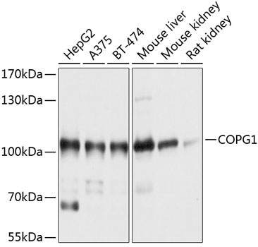 COPG1 Rabbit Polyclonal Antibody