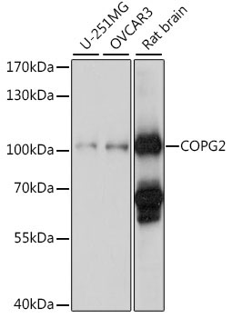 COPG2 Rabbit Polyclonal Antibody