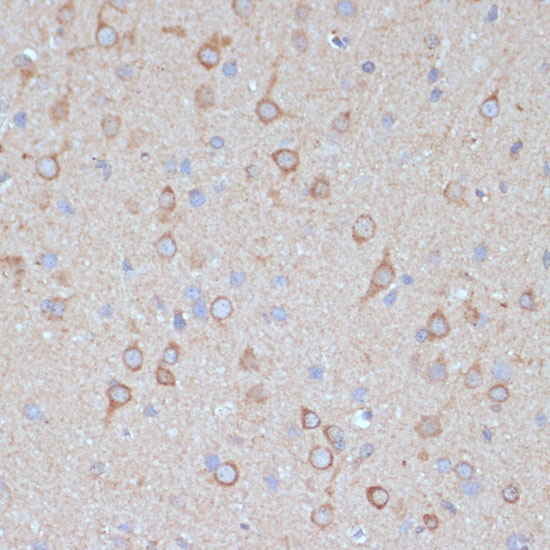 COPG2 Rabbit Polyclonal Antibody - Image 2