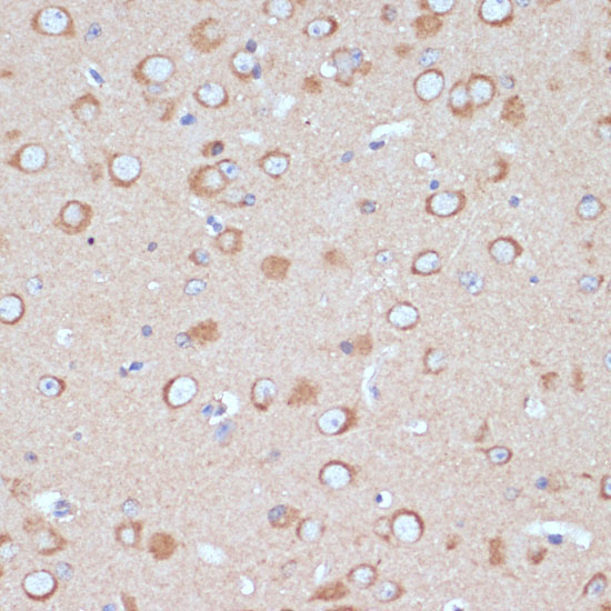 COPG2 Rabbit Polyclonal Antibody - Image 3
