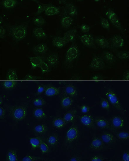 COPG2 Rabbit Polyclonal Antibody - Image 4