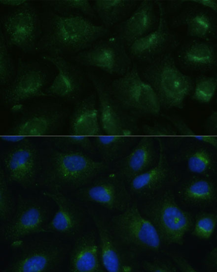 COPG2 Rabbit Polyclonal Antibody - Image 5