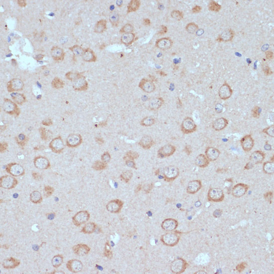 COPG2 Rabbit Polyclonal Antibody - Image 2