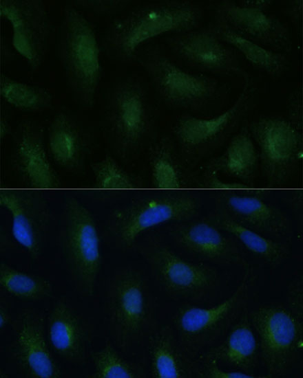 COPG2 Rabbit Polyclonal Antibody - Image 3