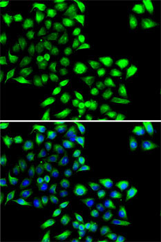 COPS6 Rabbit Polyclonal Antibody - Image 2