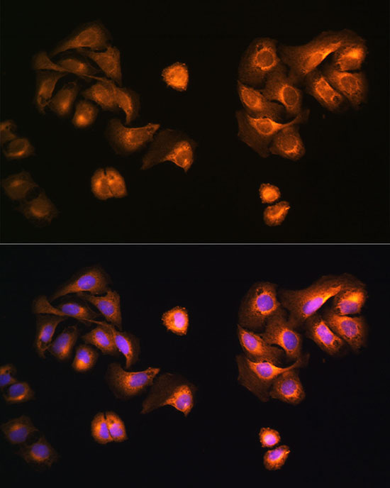 COPZ1 Rabbit Polyclonal Antibody - Image 2
