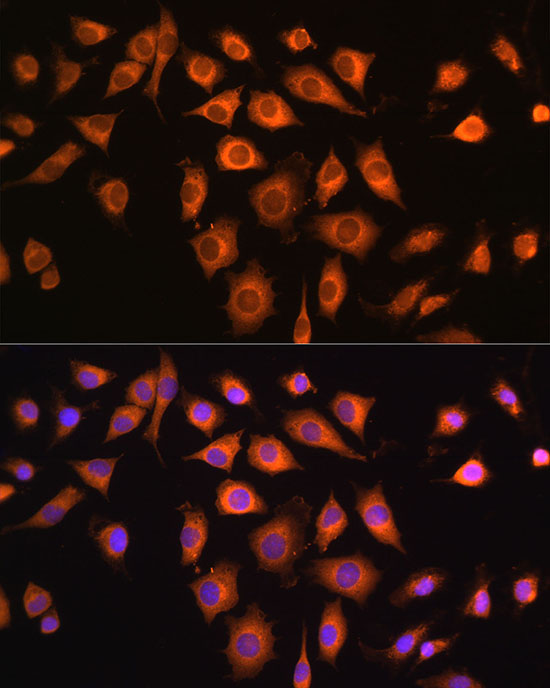 COPZ1 Rabbit Polyclonal Antibody - Image 3