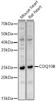 COQ10B Rabbit Polyclonal Antibody