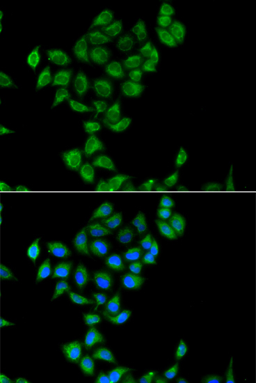 COQ3 Rabbit Polyclonal Antibody - Image 2