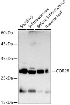 COR28 Rabbit Polyclonal Antibody