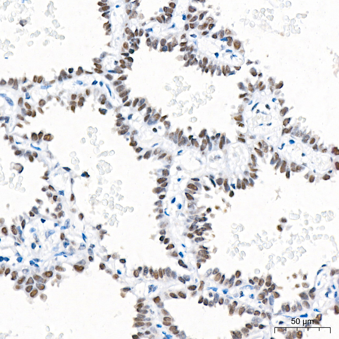 CoREST/RCOR1 Rabbit Monoclonal Antibody