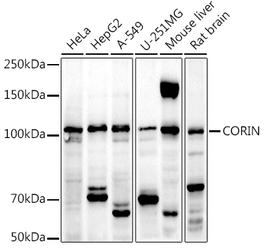 CORIN Rabbit Polyclonal Antibody