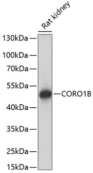 CORO1B Rabbit Polyclonal Antibody