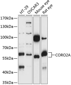 CORO2A Rabbit Polyclonal Antibody