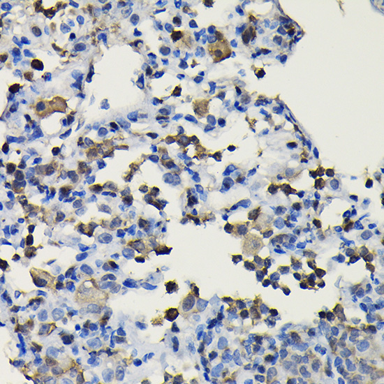 COTL1 Rabbit Polyclonal Antibody - Image 2