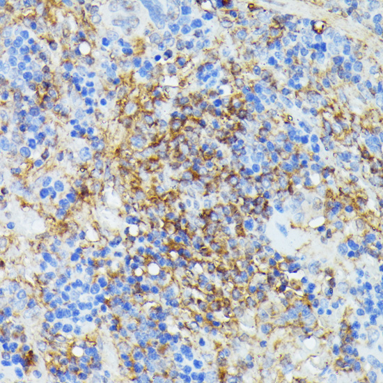 COX15 Rabbit Polyclonal Antibody - Image 2
