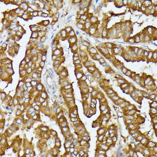 COX15 Rabbit Polyclonal Antibody - Image 3