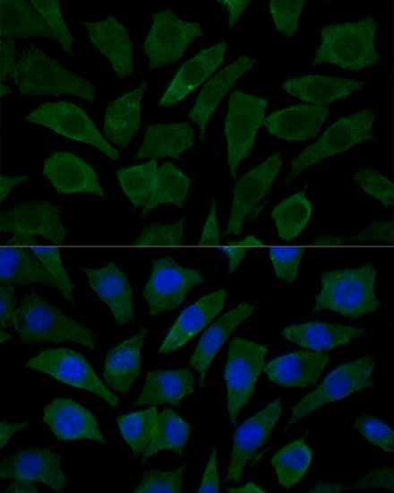 COX15 Rabbit Polyclonal Antibody - Image 5