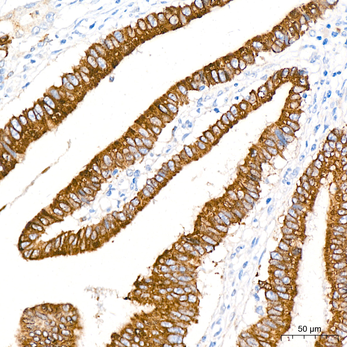 COX2/PTGS2 Rabbit Monoclonal Antibody - Image 2