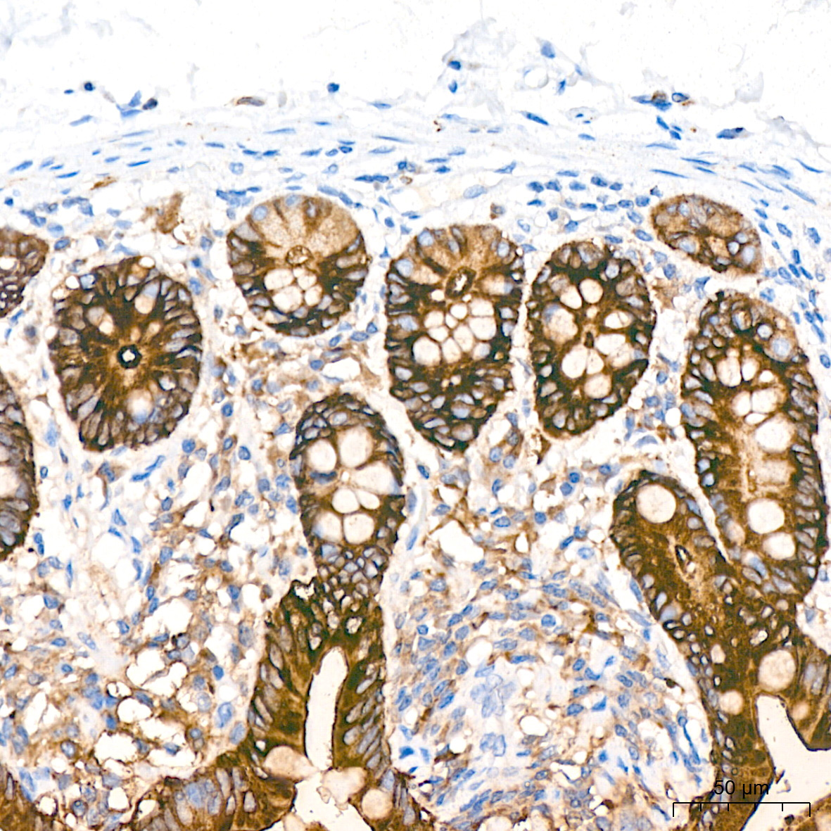 COX2/PTGS2 Rabbit Monoclonal Antibody - Image 3