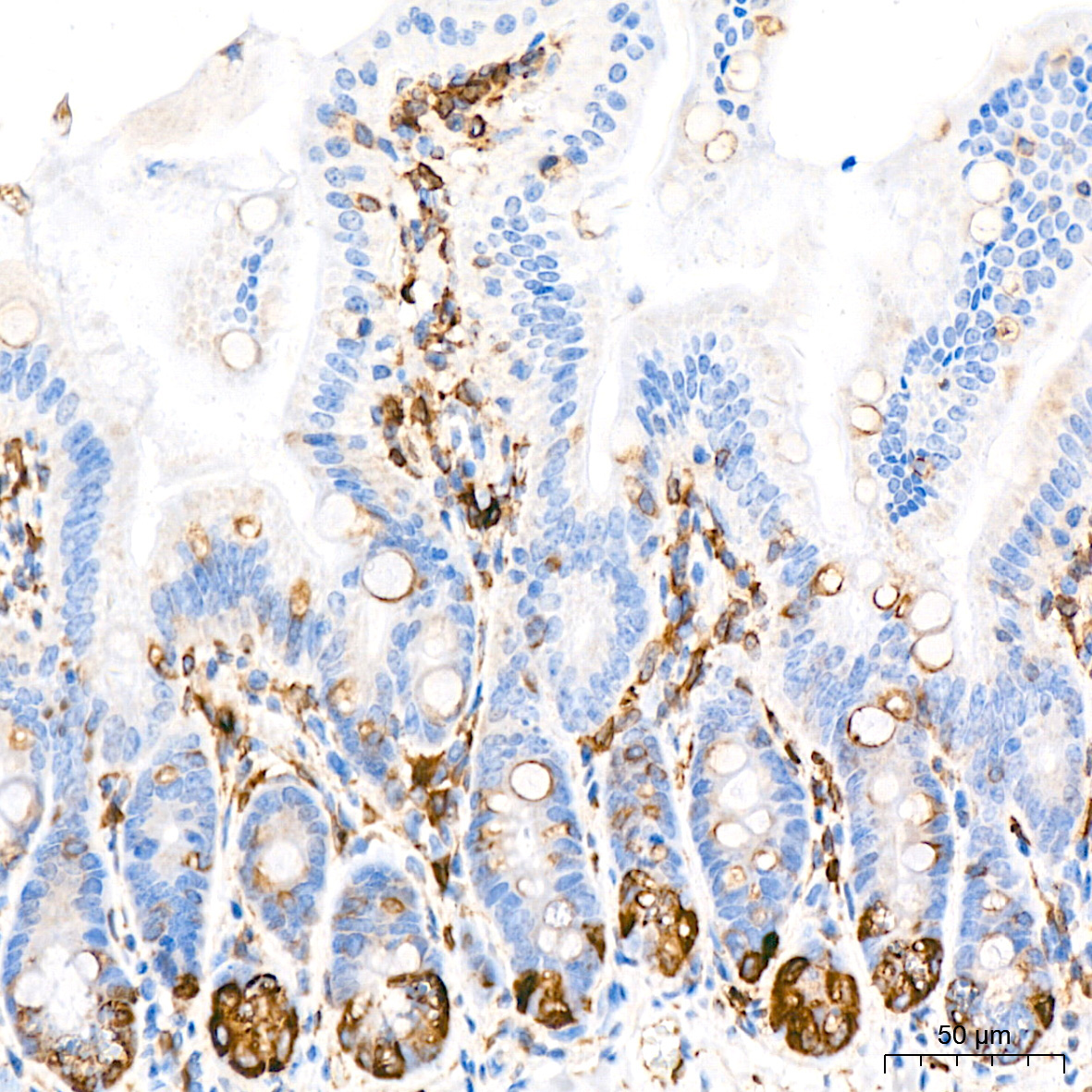 COX2/PTGS2 Rabbit Monoclonal Antibody - Image 4
