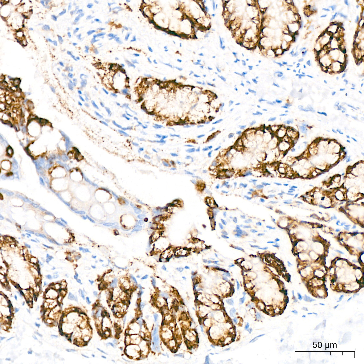 COX2/PTGS2 Rabbit Monoclonal Antibody - Image 5