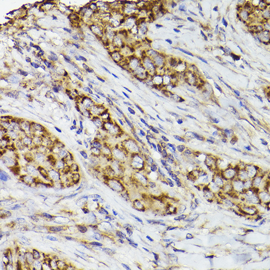 COX2/PTGS2 Rabbit Polyclonal Antibody - Image 2