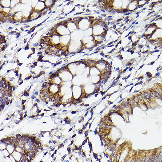 COX2/PTGS2 Rabbit Polyclonal Antibody - Image 3