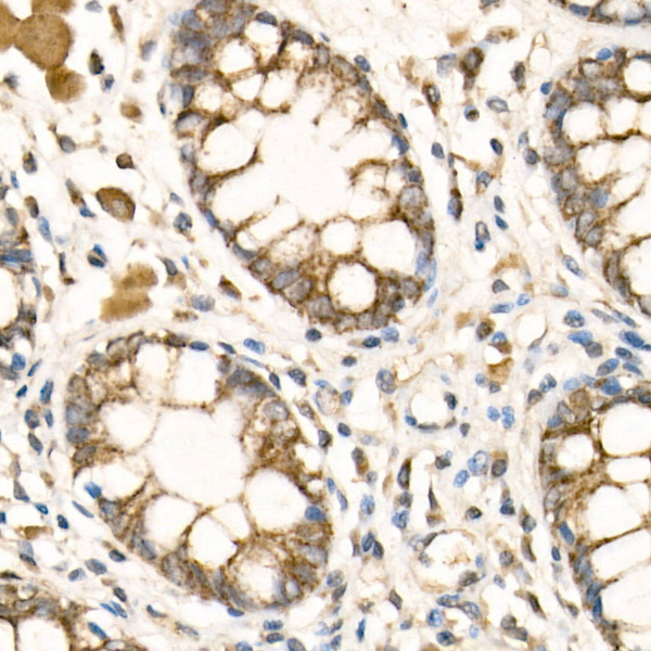 COX5B Rabbit Polyclonal Antibody - Image 2